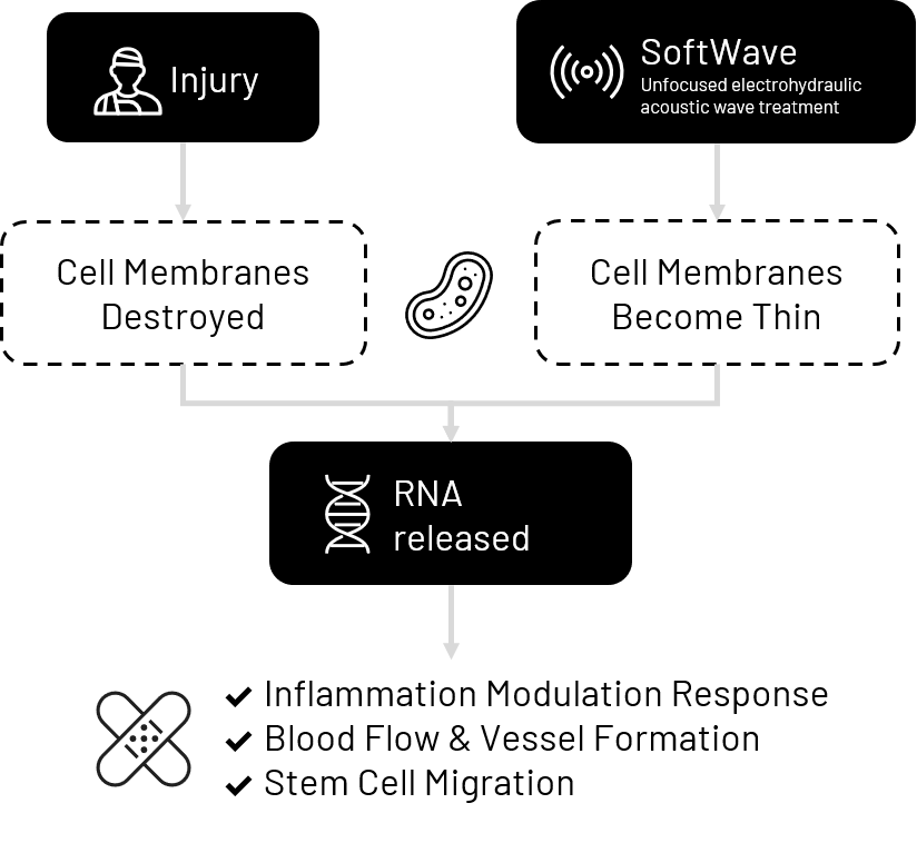 How SoftWave Works